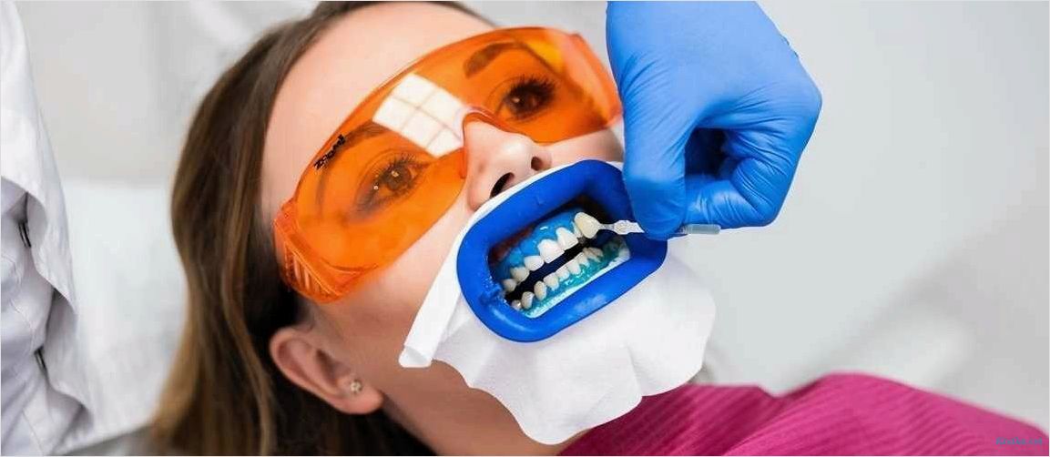 Отбеливание зубов зум
